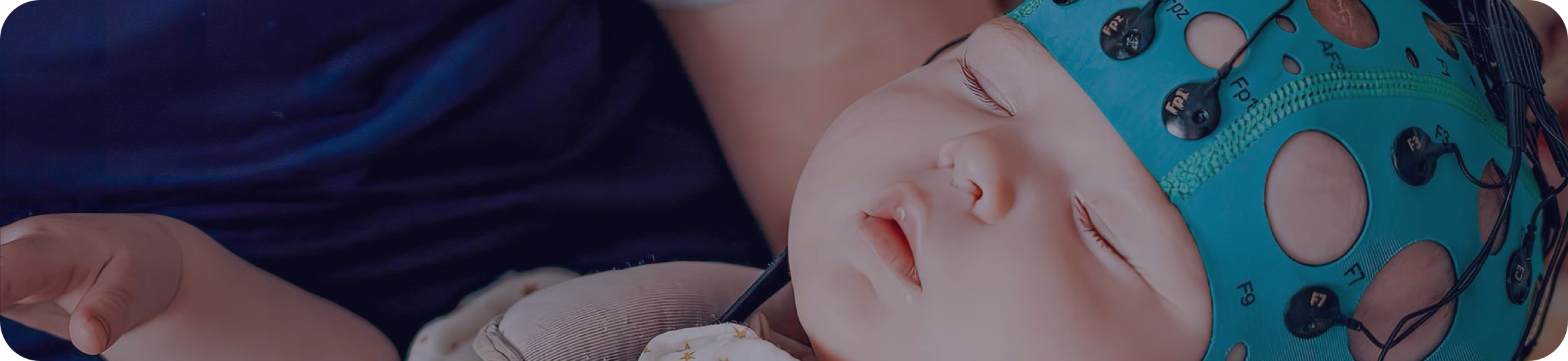 Un nouvel outil d’aide à la décision pour la prise en charge des nouveau-nés à terme, dans un contexte d’asphyxie périnatale